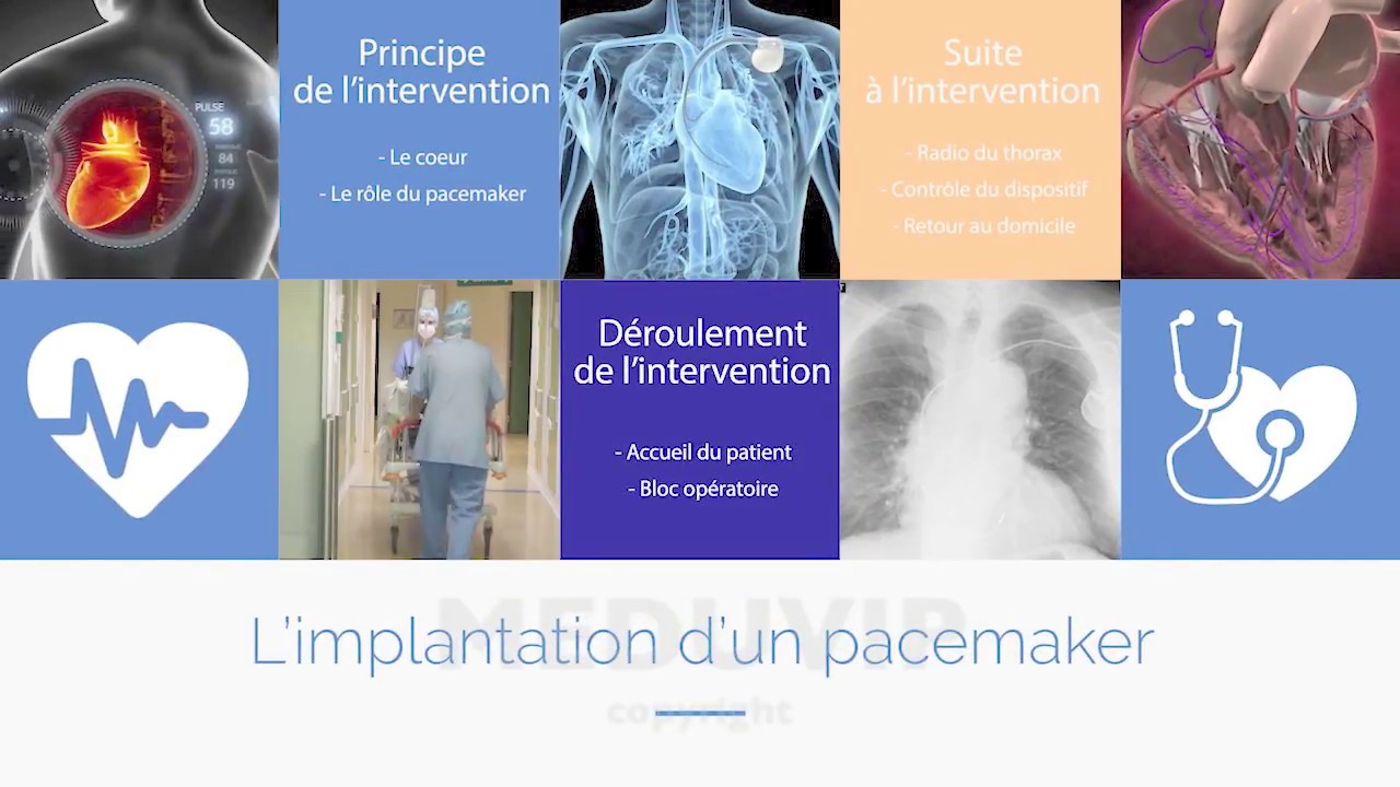 Cardioversion électrique externe Lyon  CCJJ - Centre Cardiovasculaire Jean  Jaurès