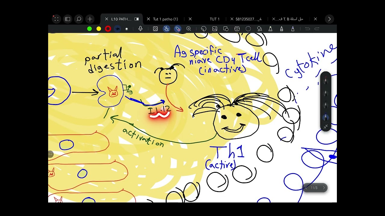 TUT1 _ diffrent types of granuloma