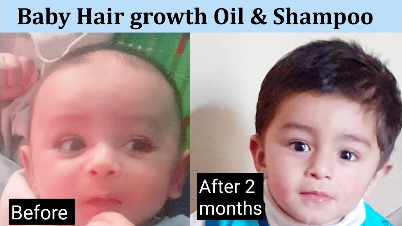 5 Things To Do From Now, For Baby Perfect Hair Growth & And Thick hairs