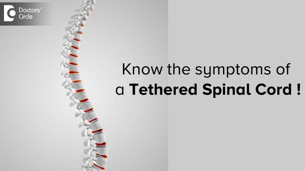 FAQ & Guide on Tethered Cord Syndrome (Symptoms, Surgery
