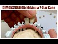 Full Process Demonstration of 7-Star (Individual Crowns on a Metal Framework)