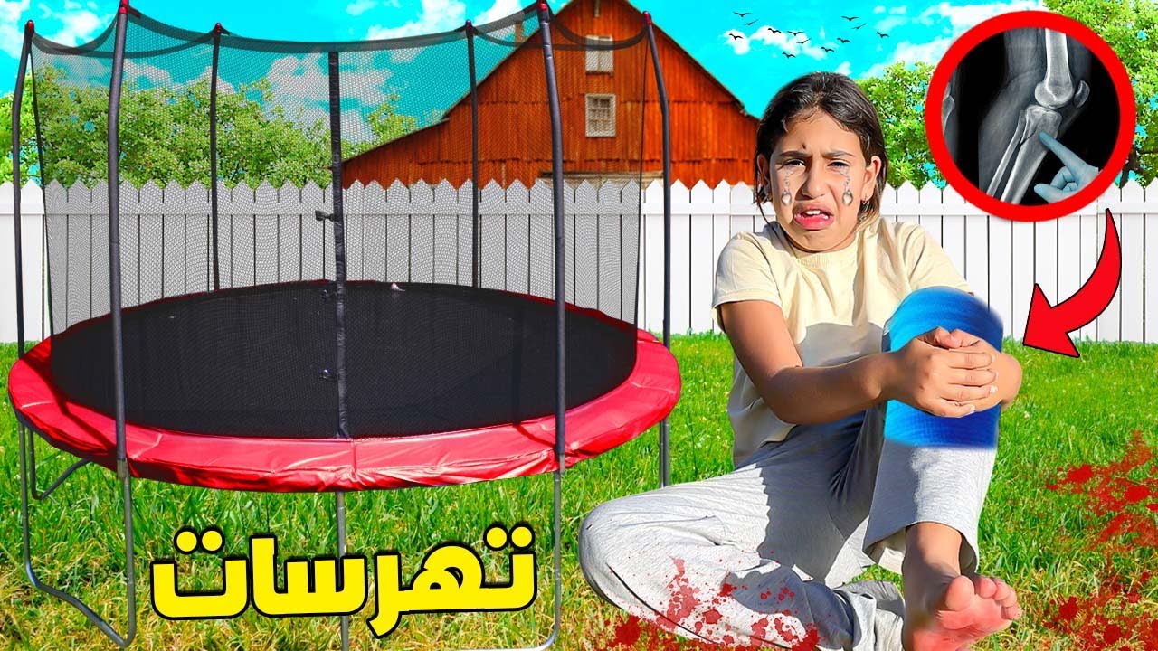 للأسف…⁉️😱 بسبب ترامبولين ديال المزرعة😨👩🏻‍🌾 تهرسات رانيا فرجليها😳(أكفس يوم 😢💔)