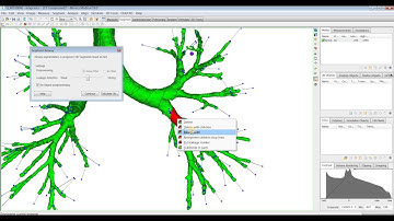 Tutorial: Mimics Innovation Suite - Segment Airway QUICKLY
