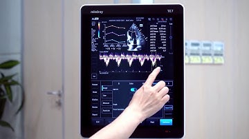 Mindray TE7 ACE Smart VTI Demo Video--ES