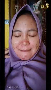 Testimoni RK Glow produk ANJ(1)