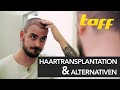 Haarausfall - Lösung: Haartransplantation? Hollywood-Stars und ihre Geheimnisse