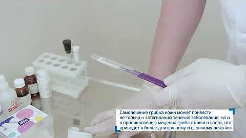 Грибковые заболевания кожи