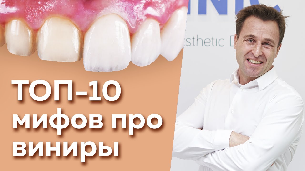 «Виниры портят зубы!» / 10 глупых мифов про виниры, в которые до сих пор верят