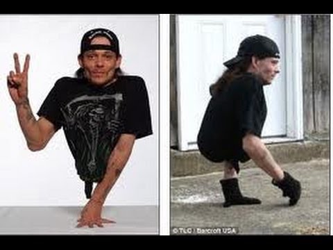 Человек половина. Моя Ужасная История. man half body