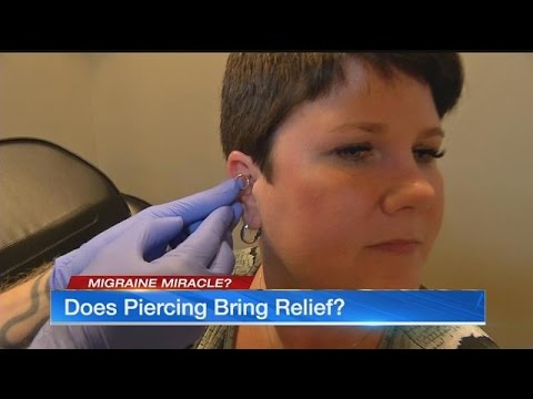 Video: Welke oorpiercing is voor migraine?