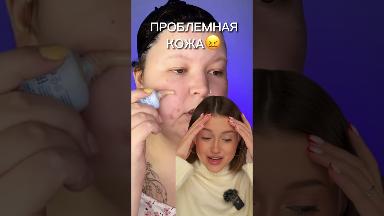 ЭТО НЕ РЕКЛАМА. Купила в аптеке«ЖИДКОСТЬ для проблемной кожи»в составе салициловая кислота