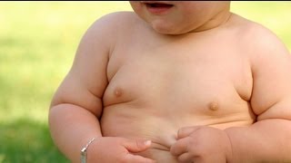 Health Issues of Childhood Obesity