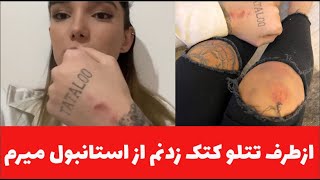 از طرف تتلو کتک زدن منو اینم از حال و روز من عجب