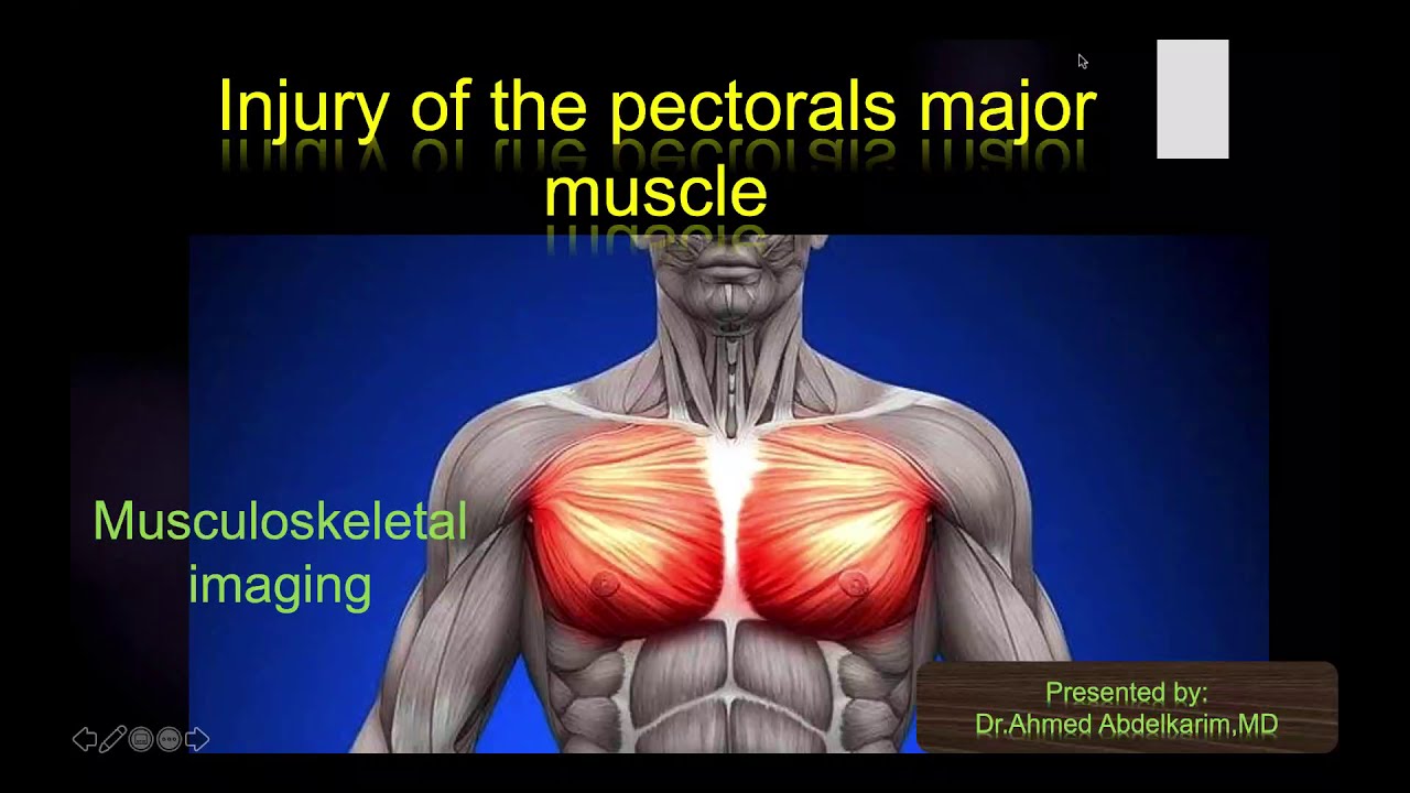 15Pectoralis major muscle injury (Protocole and radiological features
