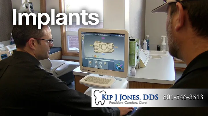 Dental Implants Utah | Layton Dentist Kip J Jones, DDS | 801-546-3513