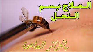 العلاج بسم النحل بالجزائر العاصمة - لجميع الأمراض المستعصية والمزمنة | BEE VENOM APiTHERAPY