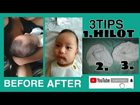 Baby Head   Shape Correction | Tips for normal Head of Baby + Long to Round