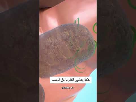 هكذا يتكون الغاز داخل الجسم  معلومات