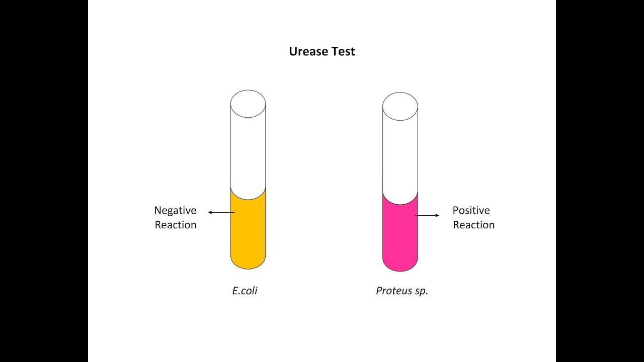 urease