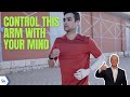 Mind-controlled prosthetic arms are now becoming a reality | Kurt the CyberGuy