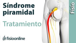 Síndrome del piramidal - Tratamiento con ejercicios, automasajes y estiramientos