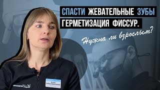 Герметизация фиссур у взрослых🌀Нужна или нет?