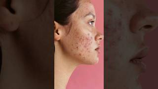 which is your skin type !! skin types serum.                            #skincare #trending #shorts