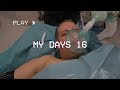 MY DAYS 16: TUMMY TUCK & BRAZILIAN BUTT LIFT | Henry Harjusola