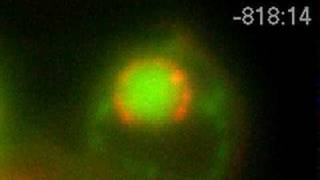 Pachtene Laco-Tel Nup49-Gfp Dapi