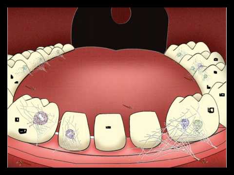 ส่งเสริม หมาย ถึง  2022 New  แมงกินฟัน.wmv