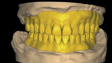 Recording 2025-05-02 000500.mp4