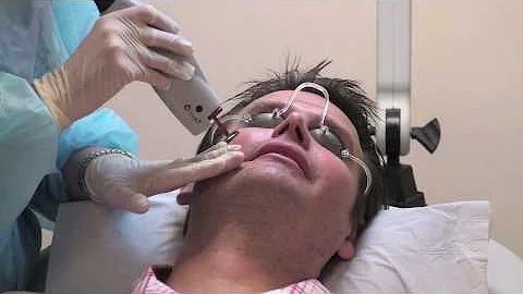 Pulsed-Dye-Laser...  Dermatologist