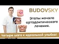 С чего начать лечение зубов? Этапы лечения у врача ортодонта. Четыре шага к идеальной улыбке!