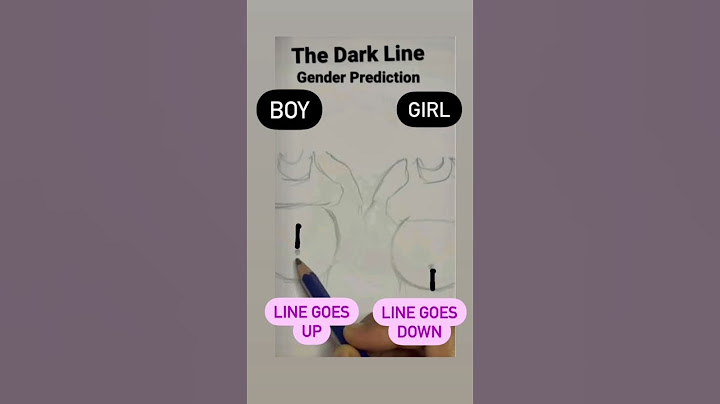 Gender Prediction with Dark line - Linea Nigra #youtubeshorts #shorts #gender #youtube #trending