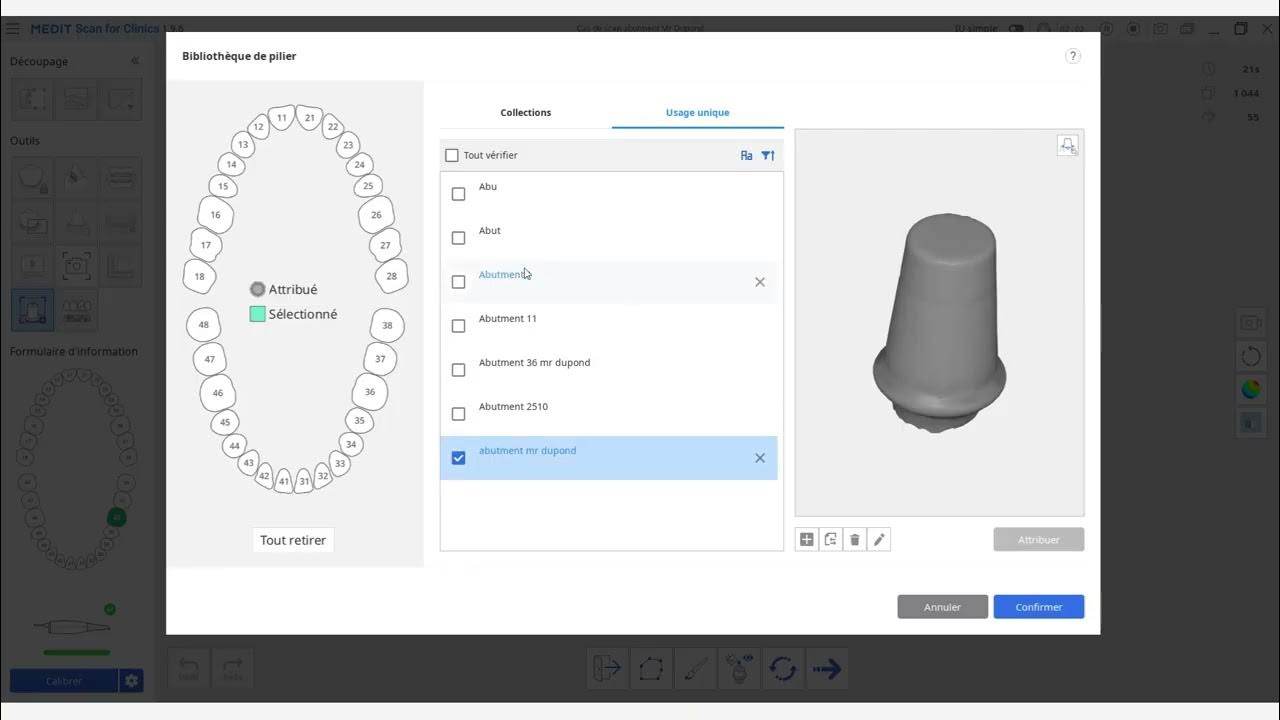 Expert De La Tour Tutoriel Scan Vf Scanner et aligner un pilier implantaire, la fonctionnalité "scan