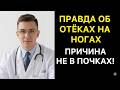 ОТЁКИ НЕ ОТ ПОЧЕК! ВРАЧ РАЗОБЛАЧАЕТ ГЛАВНУЮ ЛОЖЬ О ВОДЕ В НОГАХ!