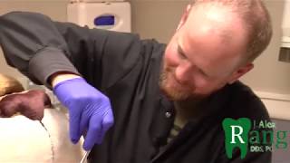 Pride finally gets his front teeth fixed, thanks to dr. alex rang!