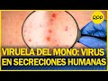 Estudio europeo detecta que virus de la viruela del mono se encuentra en secreciones humanas