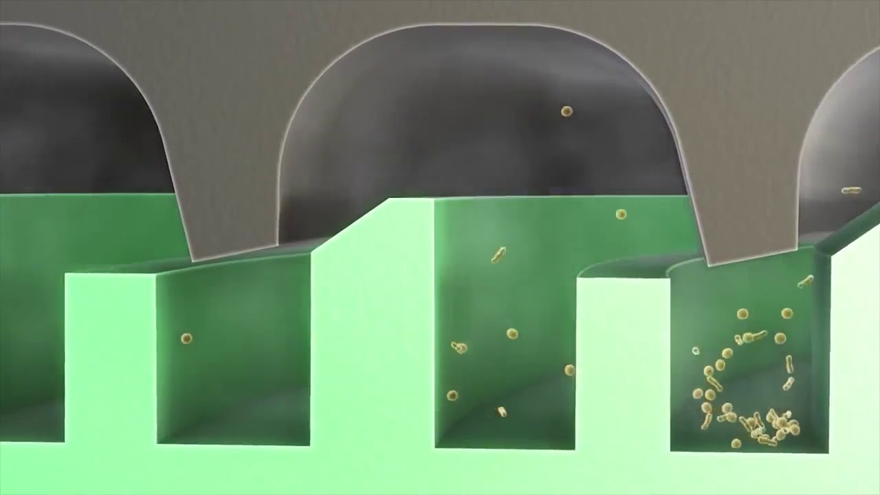 microStop® sterilization container by KLS Martin