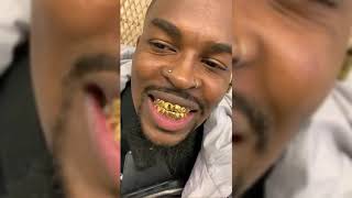 Supergold | Grillz by Scotty Episode 3