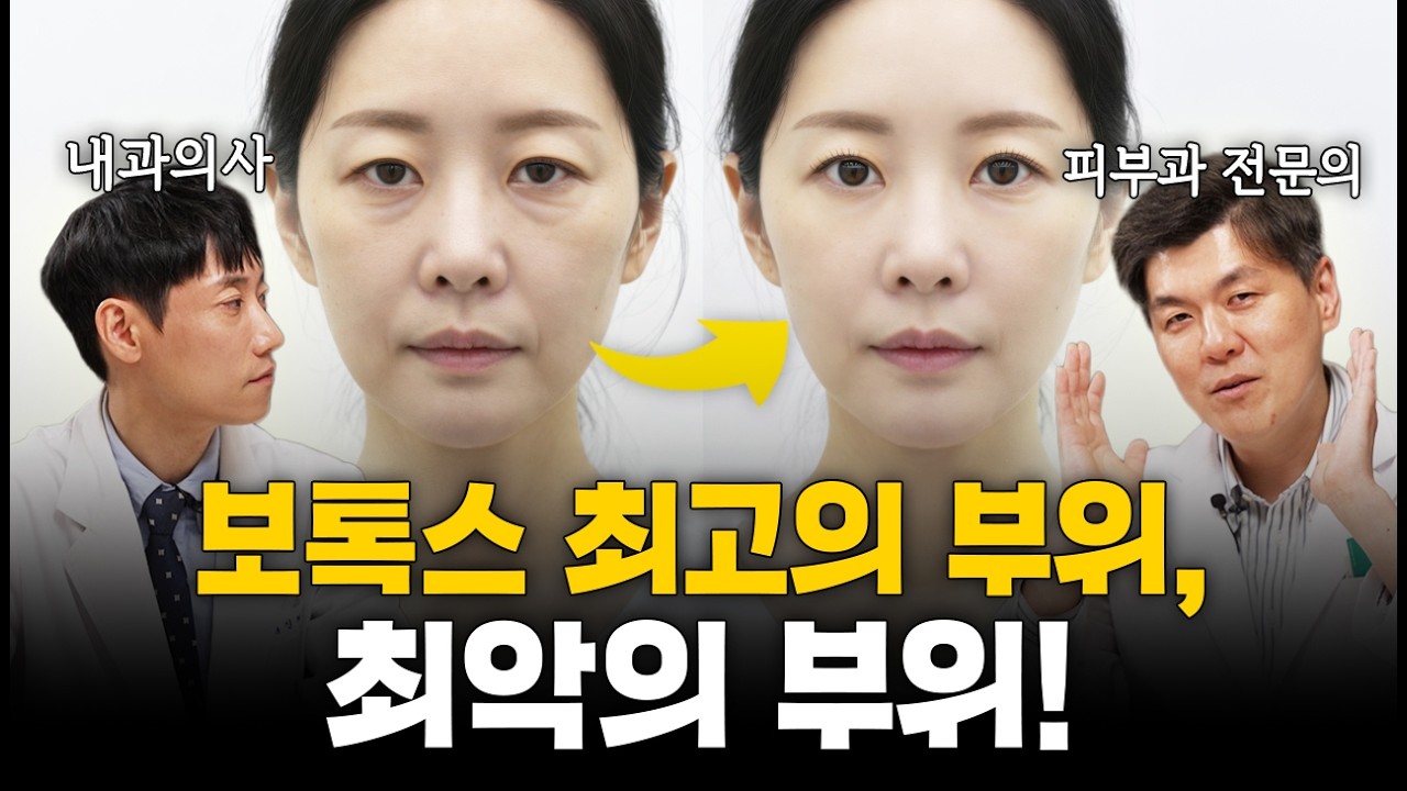 보톡스 수만 건 놓은 의사가 찾은 최고의 부위!ㅣ성현철 전문의 1부ㅣ닥터딩요