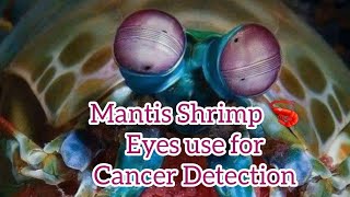 Mantis shrimp 🦐 eyes used to detect cancer