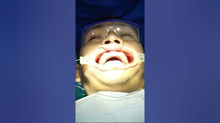 ¡Adiós Brackets, Hola Sonrisa Libre! 🦷💖