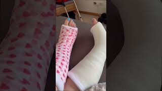 Does This Leg Cast Match My Red Toes? Chictoes Color Harmony Reveal