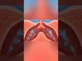 Asthma Attack: When Airways Close In