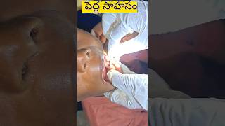 Child Safety: Stuck Bead Removal!A Brave Act! #tricks #childsafety