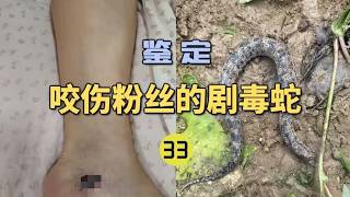 4K | 鉴定咬伤粉丝的毒蛇（33）粉丝的妈妈被不明毒蛇咬伤后凝血崩溃！血清还打错了？【世界记忆大师龙雅】