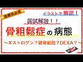 教科書をわかりやすく！「骨粗鬆症の病態」〜原因や検査をわかりやすく解説！〜
