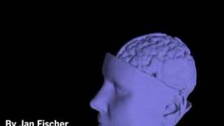 Occlusion Handling for Medical AR using a Volume Phantom