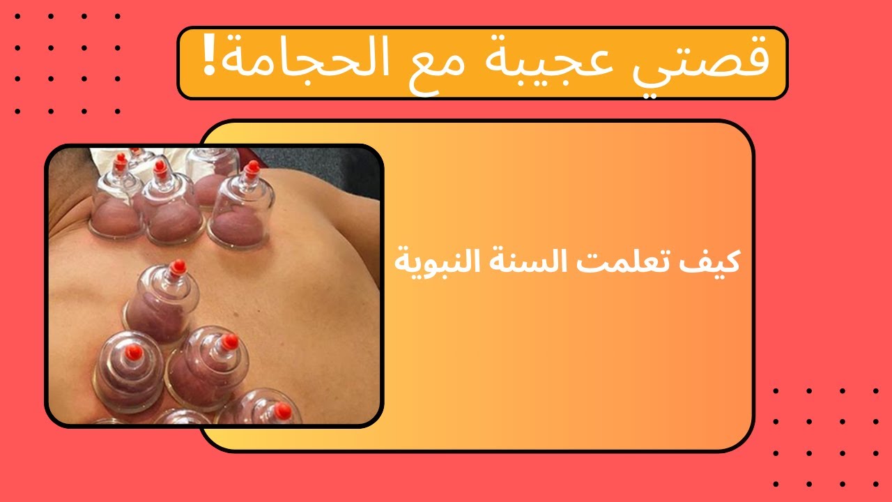 قصتي مع الحجامة وكيف تعلمتها